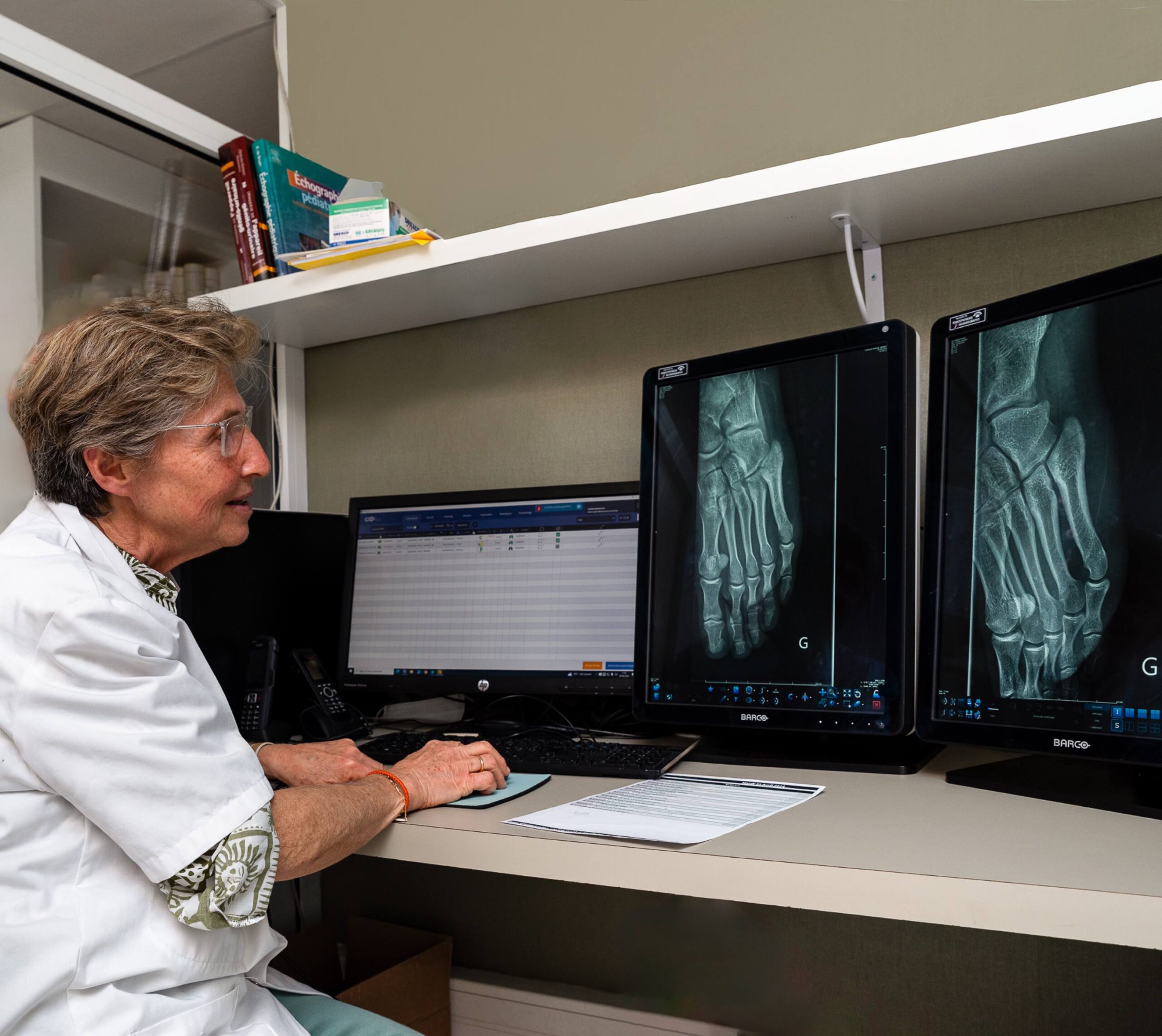 Médecin examinant des radiographies de pieds sur deux écrans d'ordinateur - radiographie | Imagerie Cardinet | Région Parisienne