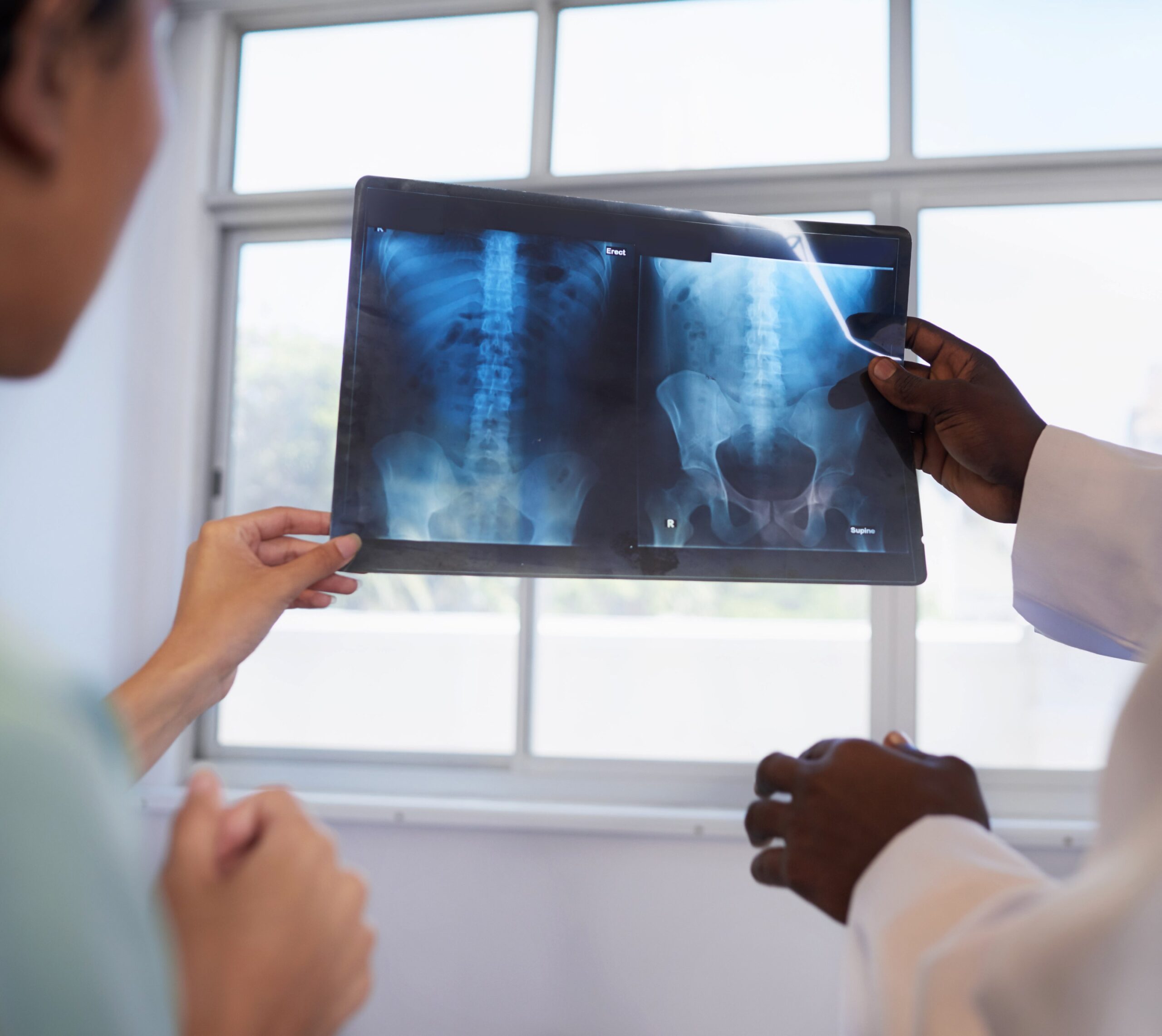 Deux médecins regardant une radiographie | radiographie abdominale | Imagerie Cardinet | Région Parisienne