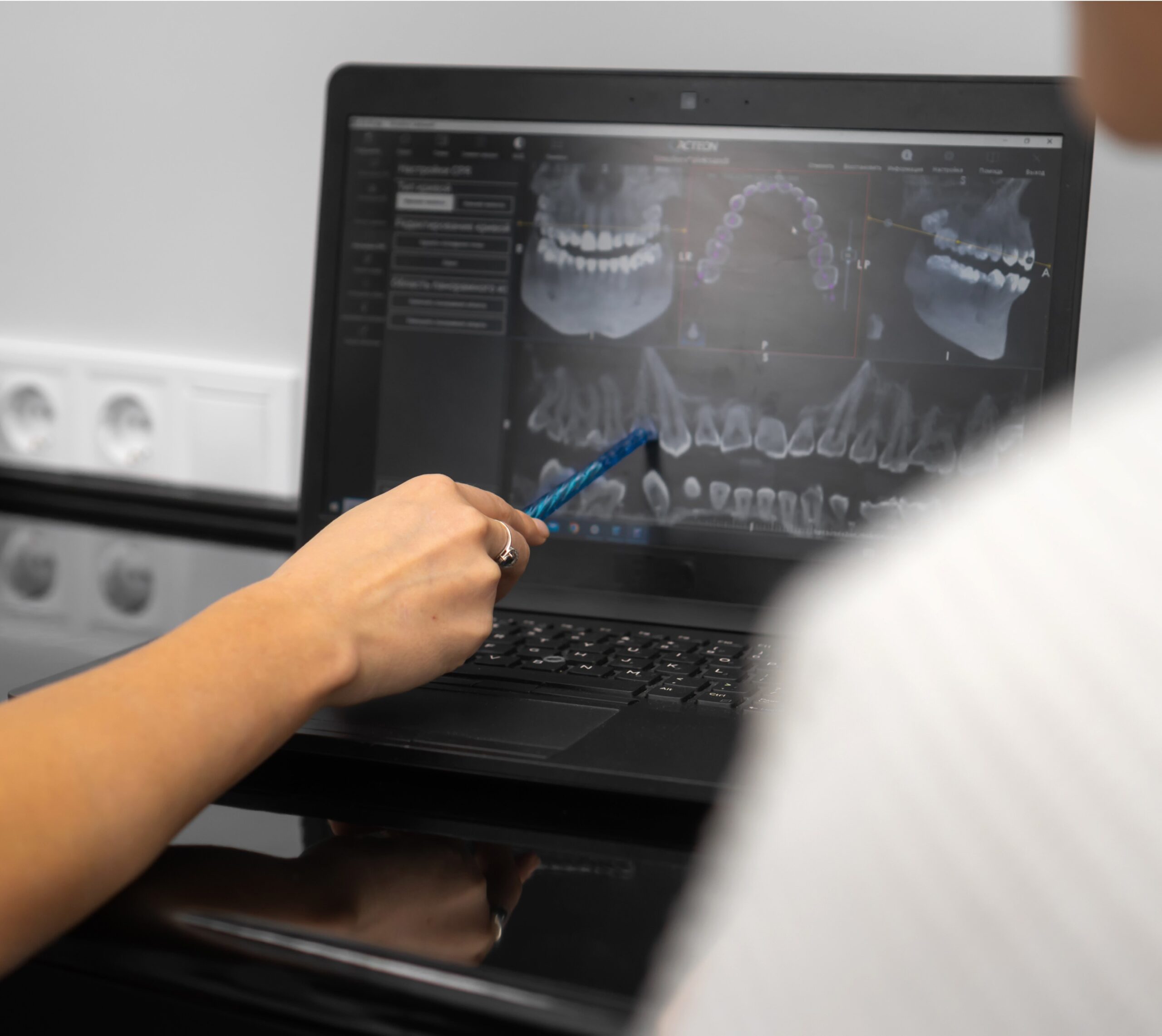 Main pointant une radiographie dentaire sur un écran - radiographie dentaire | Imagerie Cardinet | Région Parisienne