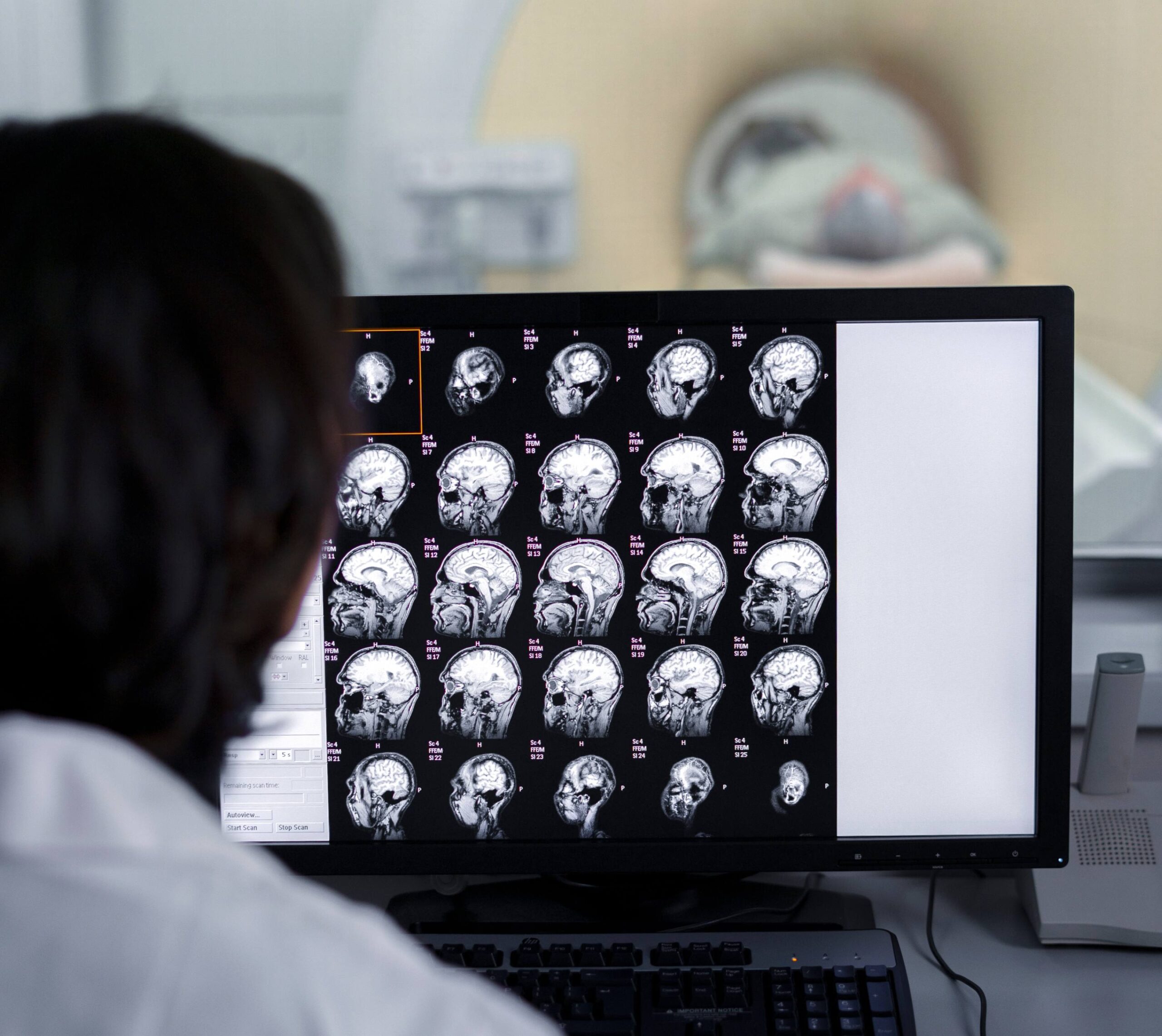 Médecin analysant une imagerie cérébral sur un écran d'ordinateur | Scanner cérébral | Imagerie Cardinet | Région Parisienne