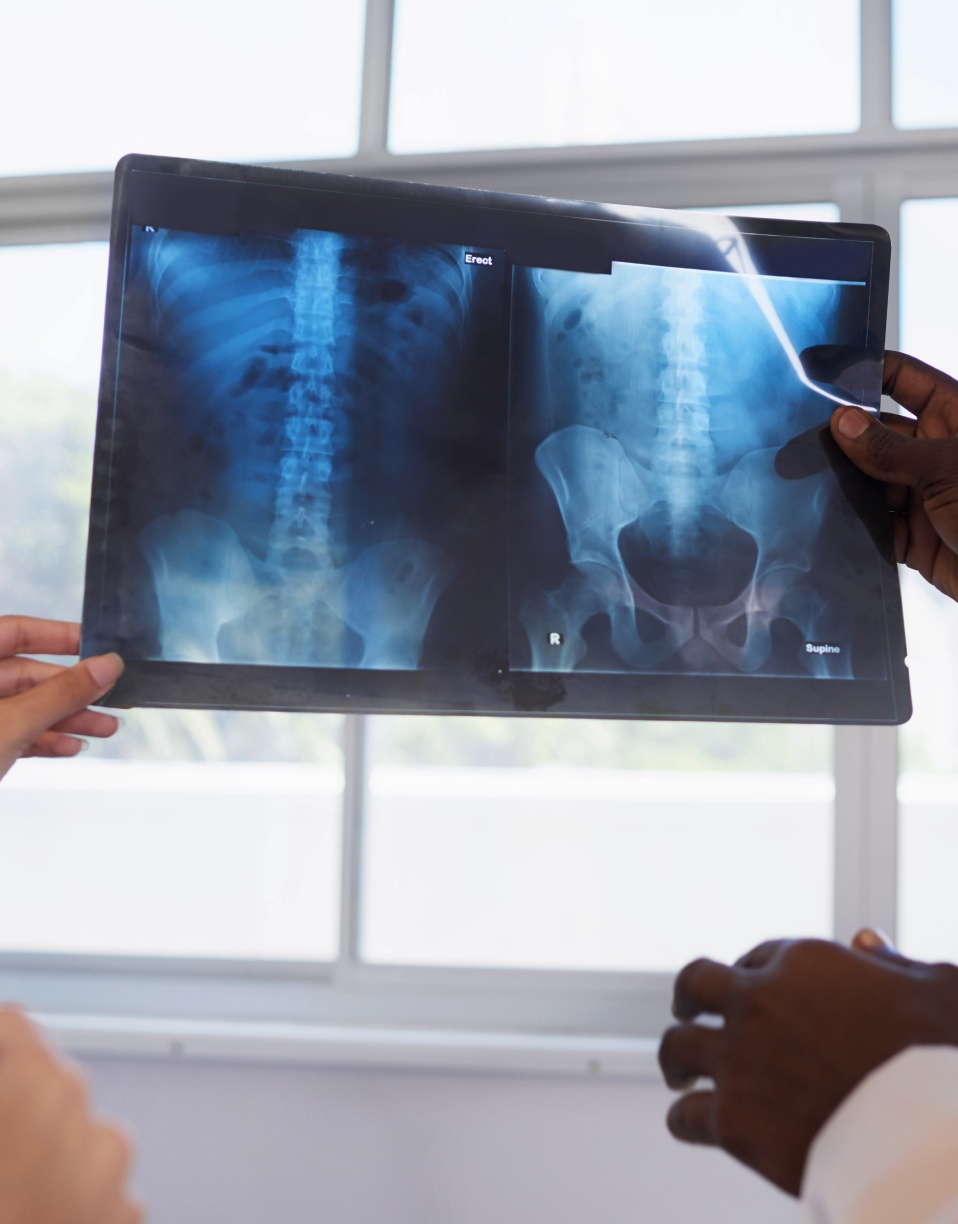 Deux personnes tiennent une radiographie montrant une colonne vertébrale et un bassin -radiographie abdominale | Imagerie Cardinet | Région Parisienne