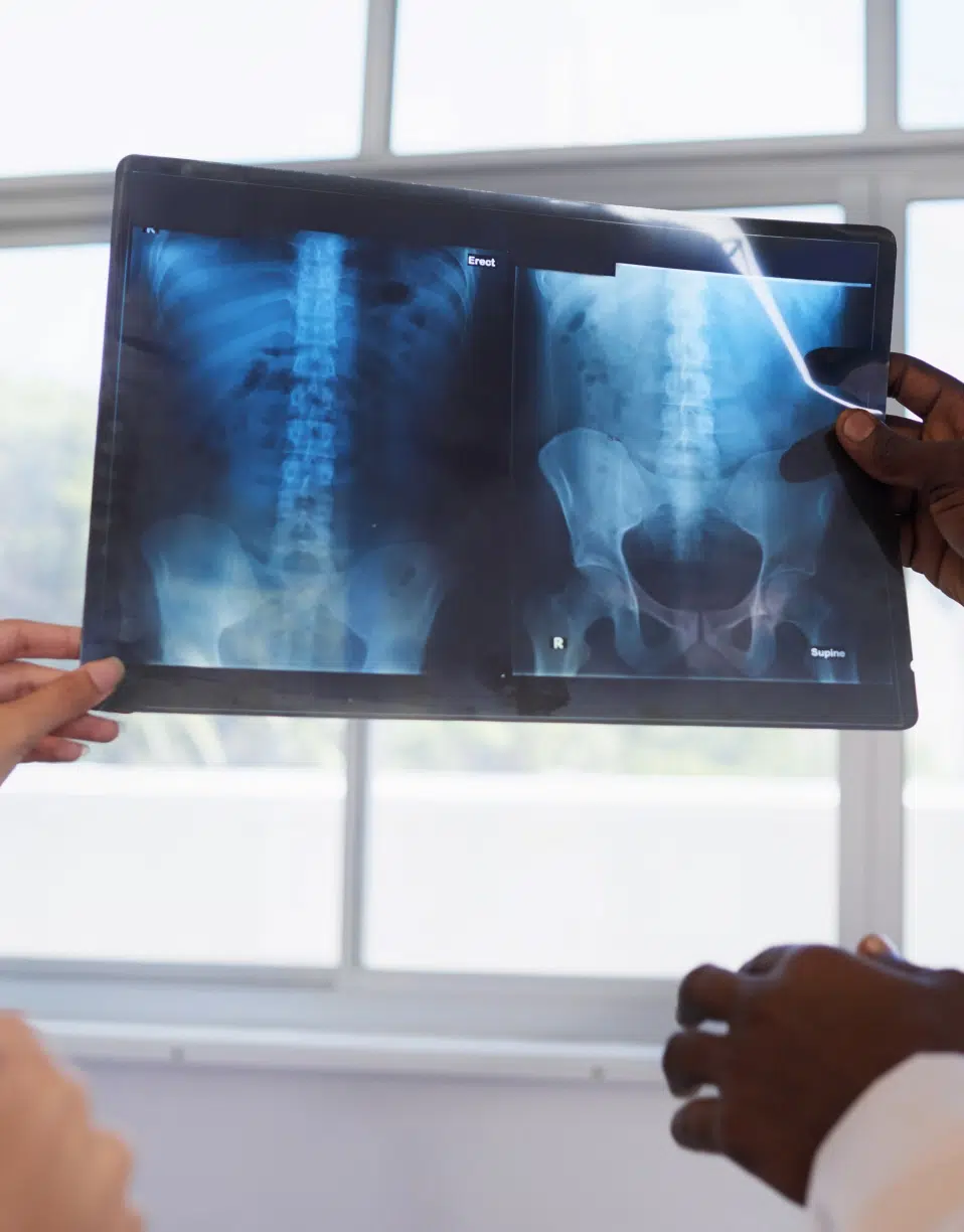 Deux personnes tiennent une radiographie montrant une colonne vertébrale et un bassin -radiographie abdominale | Imagerie Cardinet | Région Parisienne