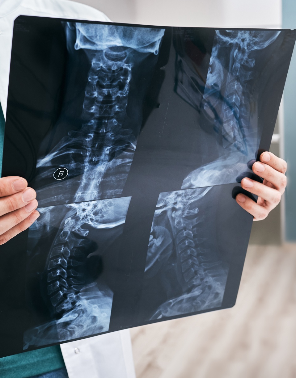 Radiographie de la colonne vertébrale cervicale et thoracique - radiographie de la colonne cervicale | Imagerie Cardinet | Région Parisienne