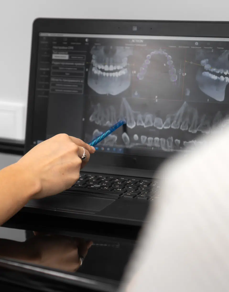 Dentiste montrant une radiographie dentaire sur un ordinateur avec un stylo - radiographie dentaire | Imagerie Cardinet | Région Parisienne