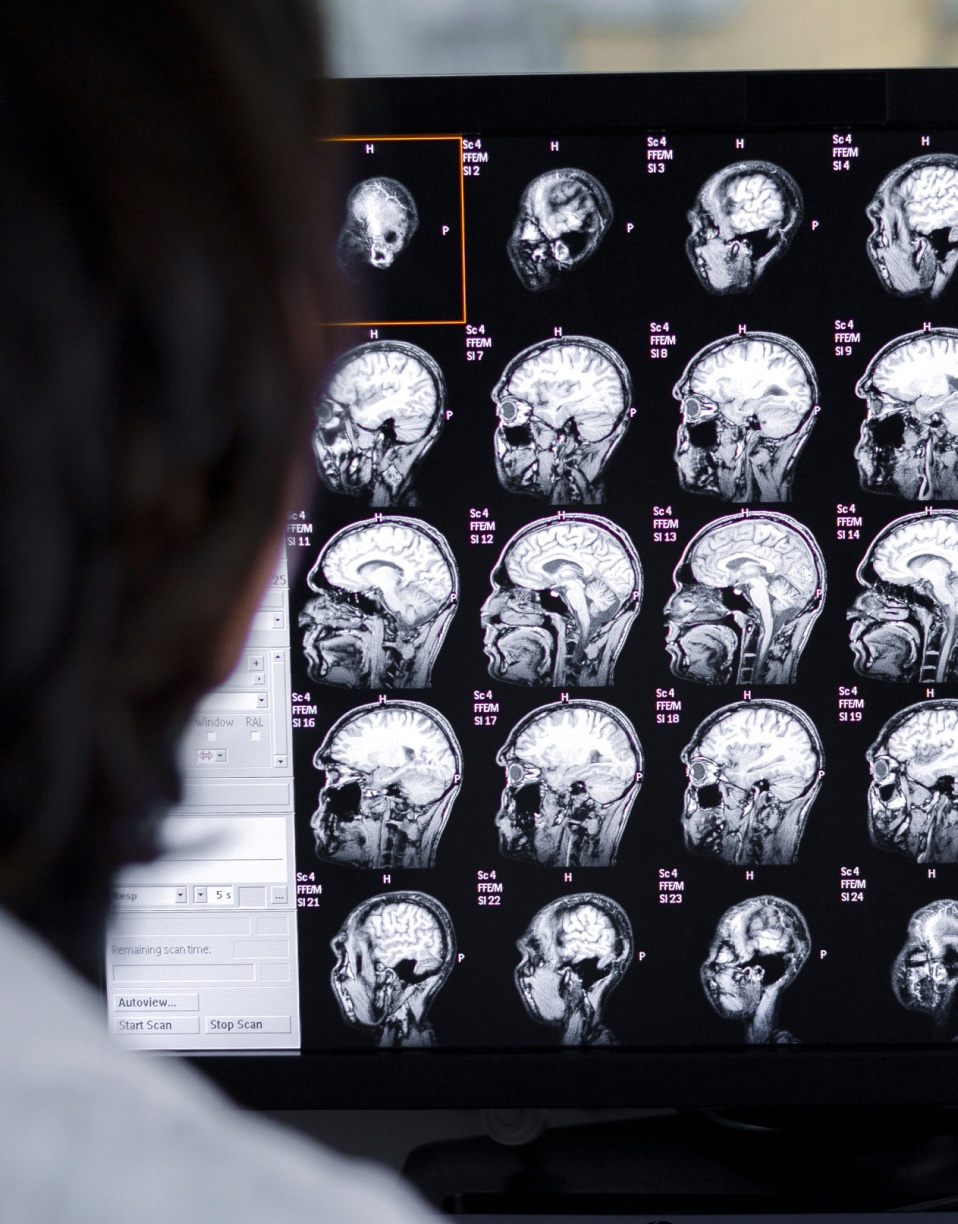 Médecin regardant une série de scans IRM du cerveau Scanner cérébral | Imagerie Cardinet | Région Parisienne