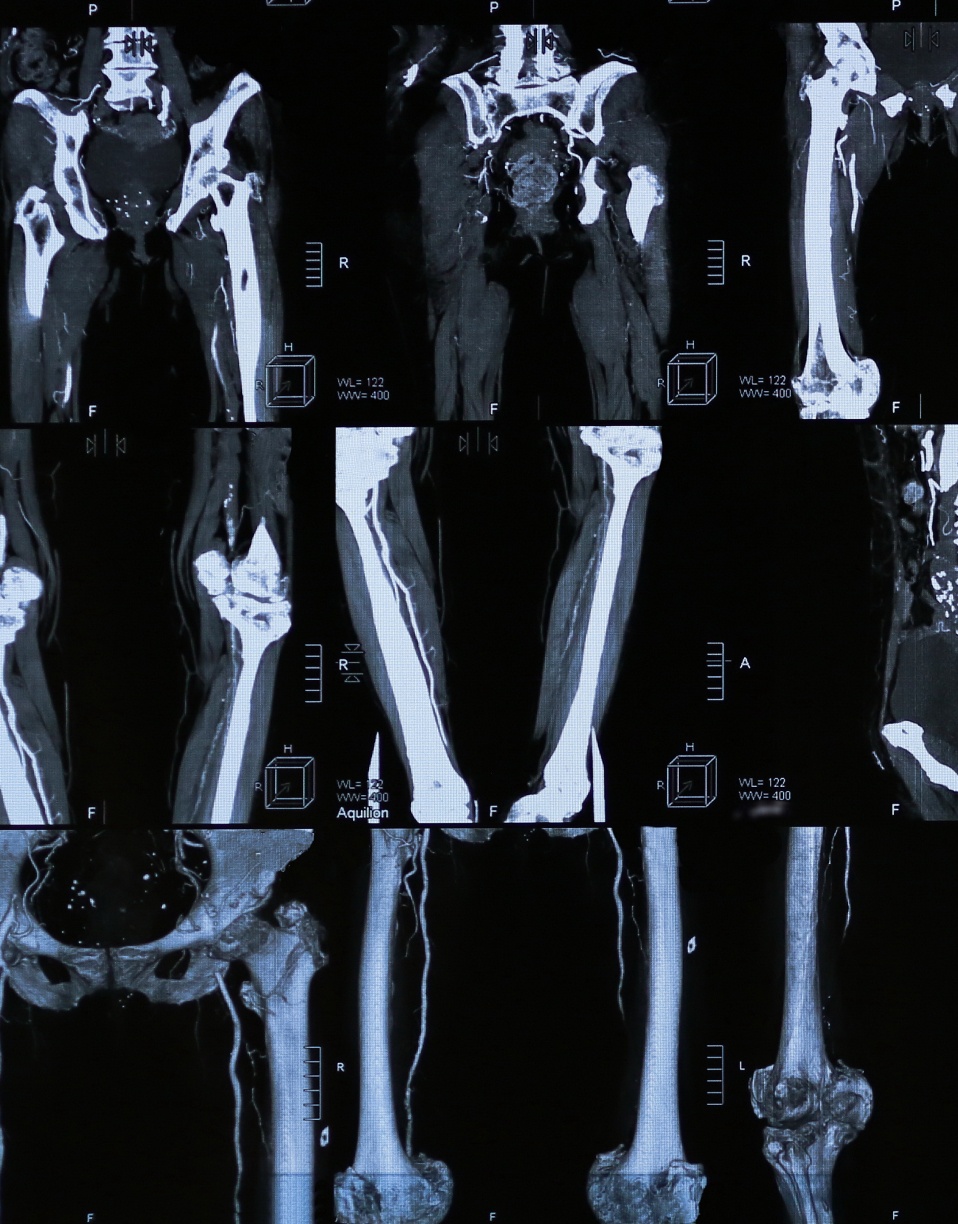 Image montrant plusieurs coupes d'une radiographie ou d'un scanner médical | scanner des membres | Imagerie Cardinet | Région Parisienne