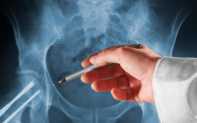 IRM pelvienne injection produit contraste | Centres Imagerie Cardinet | Paris