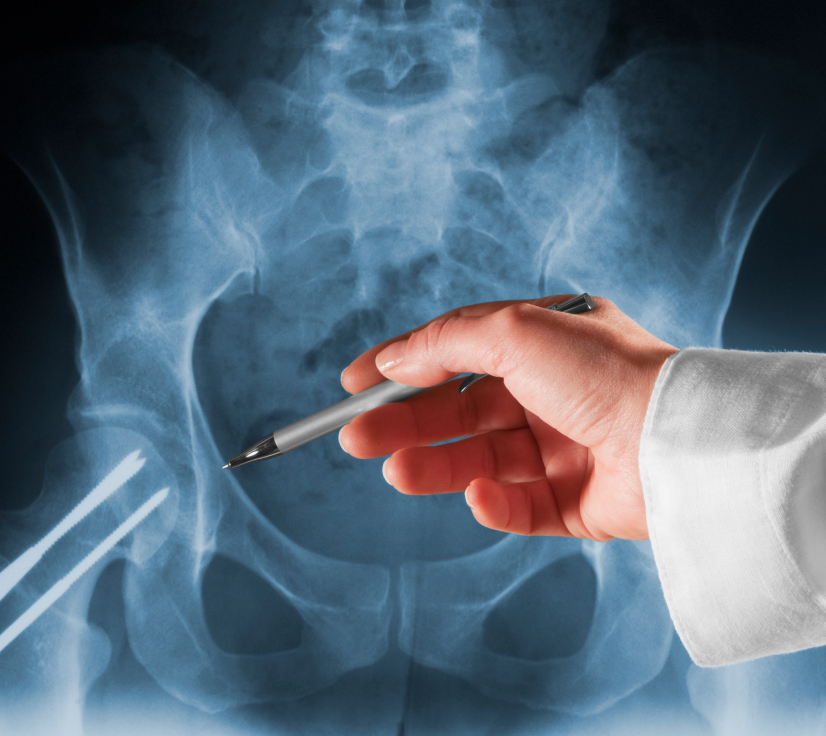 IRM pelvienne : injection de produit de contraste ou non ? | Centres ...