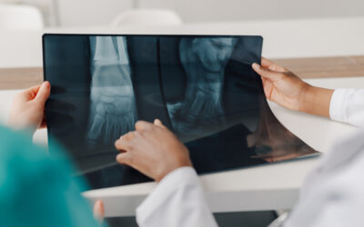 Quelles pathologies justifient infiltration pied | Centres Imagerie Cardinet | Paris