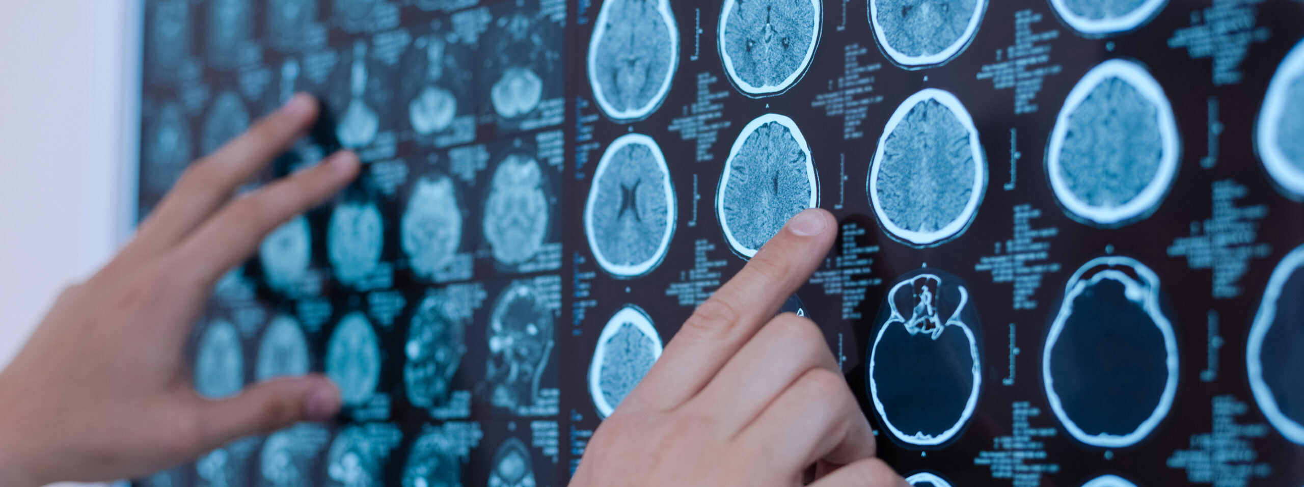 IRM cérébrale troubles neurologiques détecter | Imagerie Cardinet | Paris