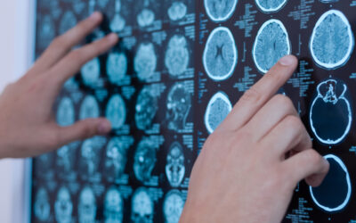IRM cérébrale troubles neurologiques détecter | Imagerie Cardinet | Paris