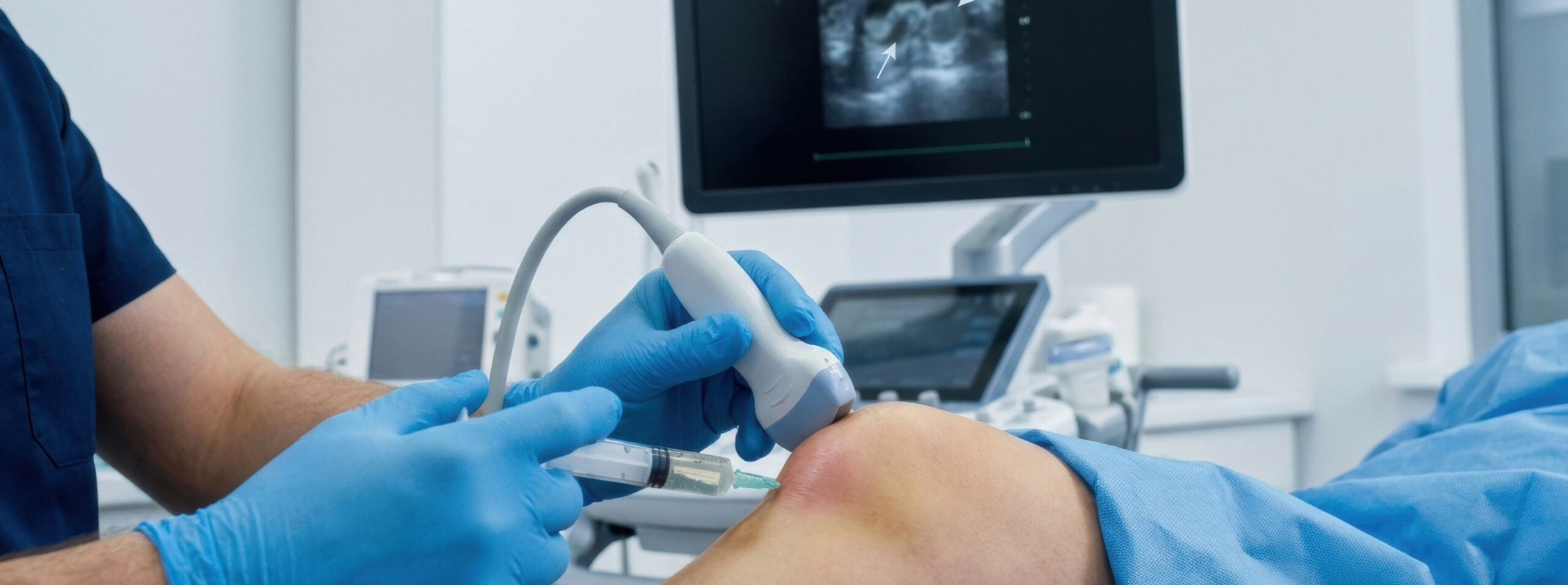 Infiltration genou scanner échographie quelle méthode | Imagerie Cardinet | Région parisienne